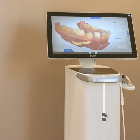 Monitor mit 3D Modell vom Gebiss eines Patienten - quadratisches Format