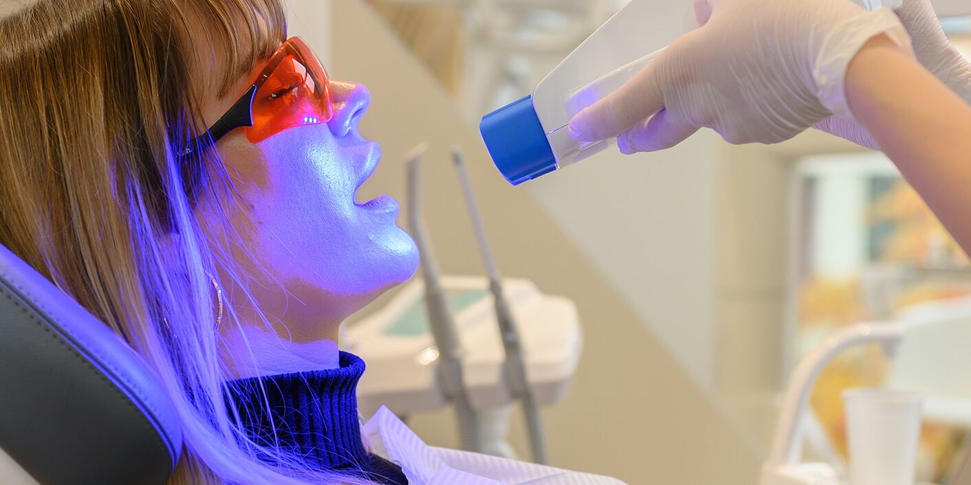 Zahnbleaching Stuttgart WEISS32 Degerloch