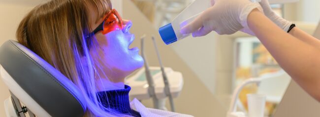 Weiss32_Bleaching_1920x706px Zahnbleaching Stuttgart WEISS32 Degerloch