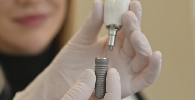 implantologie Zahnimplantate Stuttgart WEISS32 Degerloch