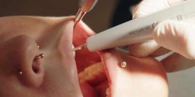 Erste-Hilfe-Maßnahmen nach einem Zahnunfall - So retten Sie einen abgebrochenen ausgeschlagenen Zahn