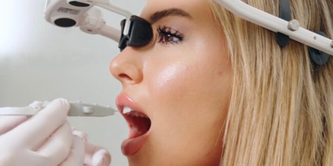 Kiefergelenkbeschwerden Viele Symptome, eine Ursache feature image-min