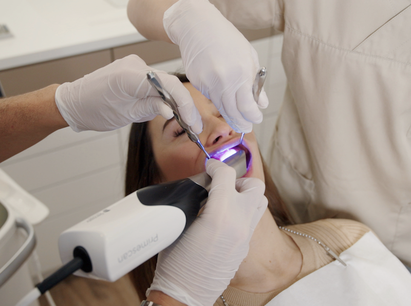 Zahnpräparation für Veneers Stuttgart