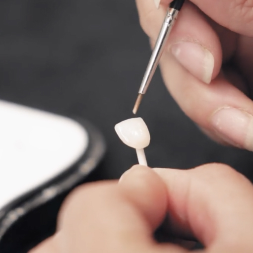 Nahaufnahme von natürlich schönen Lippen und Zähnen nach Lumineers-Behandlung bei WEISS32