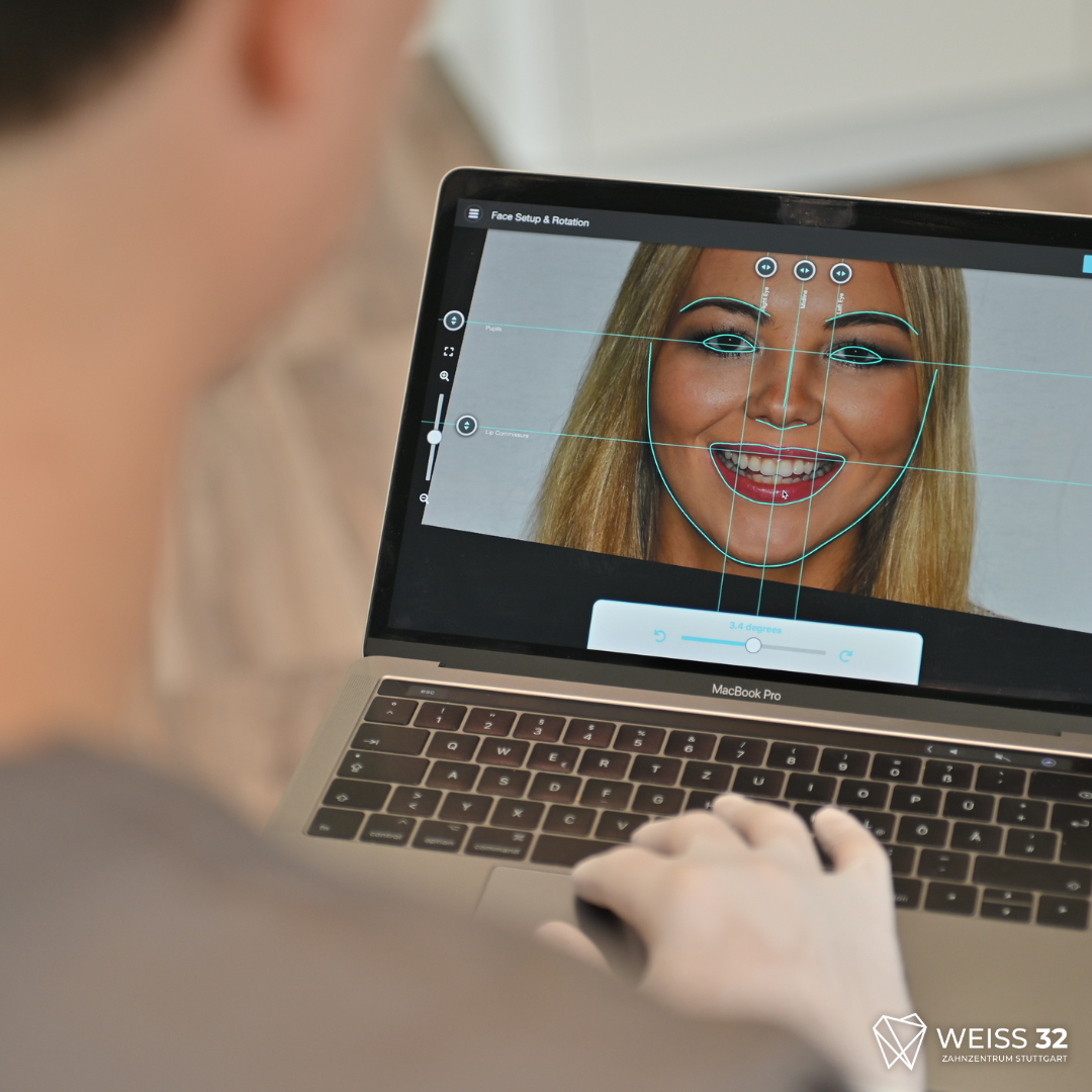 Digitales Smile Design - Vorher-Nachher-Visualisierung für Zahnästhetik bei WEISS32