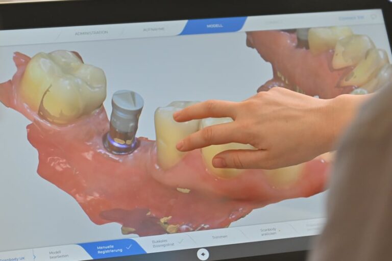 weiss32 photo Praxiseigenes Labor Blog Implantate oder Brücke – Zahnersatz-Vergleich WEISS32 Stuttgart