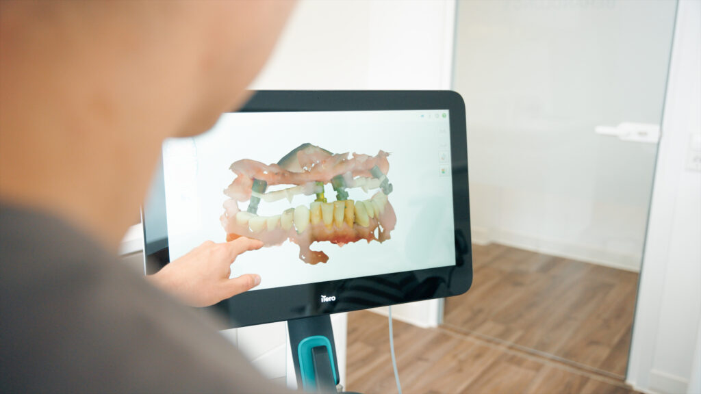 Beratung und 3D-Planung — All-on-X Erstgespräch im WEISS32 Stuttgart